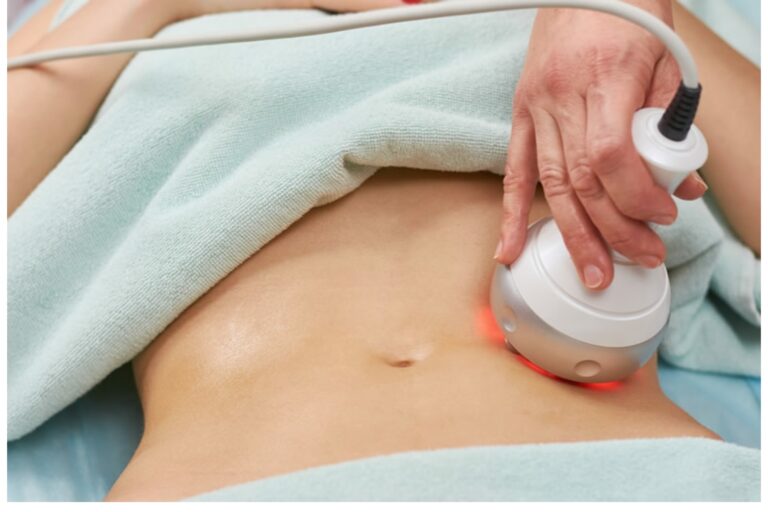 Radio Frequency Treatment for body